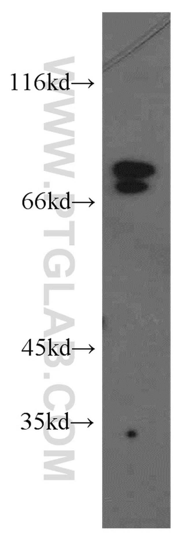 NF2 Antibody in Western Blot (WB)