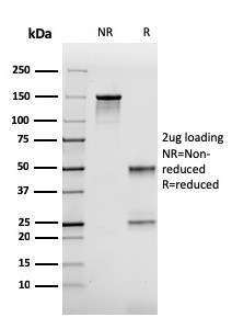 FABP2 (Marker of Metastatic Potential in Colorectal Cancer) Antibody in SDS-PAGE (SDS-PAGE)