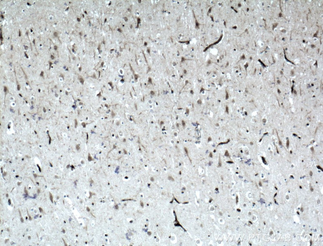 ODZ1 Antibody in Immunohistochemistry (Paraffin) (IHC (P))