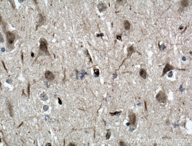 ODZ1 Antibody in Immunohistochemistry (Paraffin) (IHC (P))