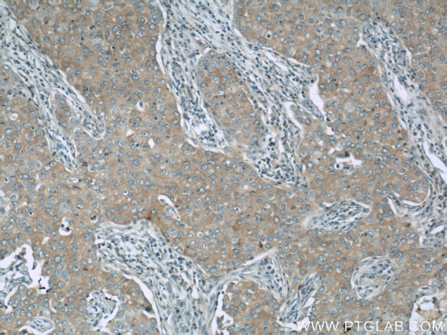 NEDD4 Antibody in Immunohistochemistry (Paraffin) (IHC (P))