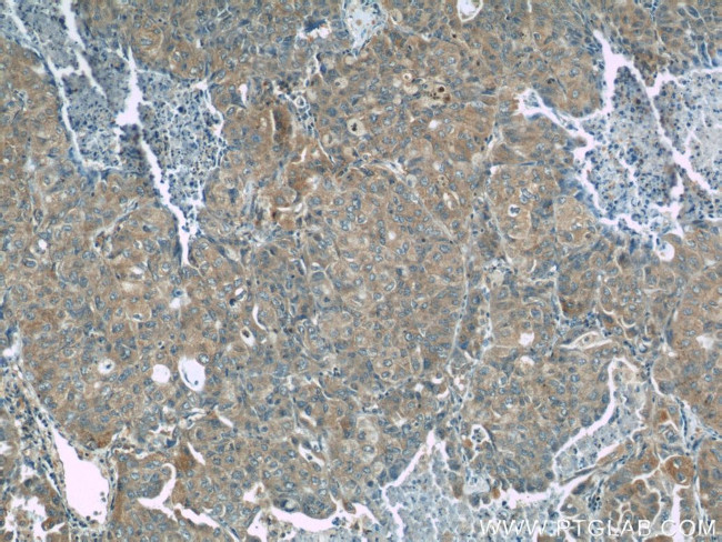 NEDD4 Antibody in Immunohistochemistry (Paraffin) (IHC (P))