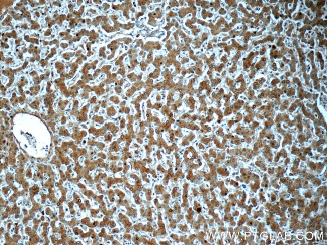 NEDD4 Antibody in Immunohistochemistry (Paraffin) (IHC (P))