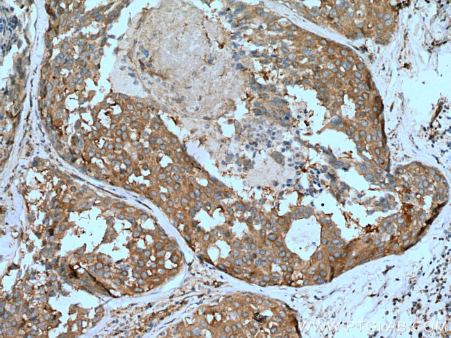 NEDD4 Antibody in Immunohistochemistry (Paraffin) (IHC (P))