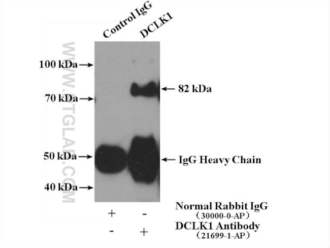 DCLK1 Antibody in Immunoprecipitation (IP)