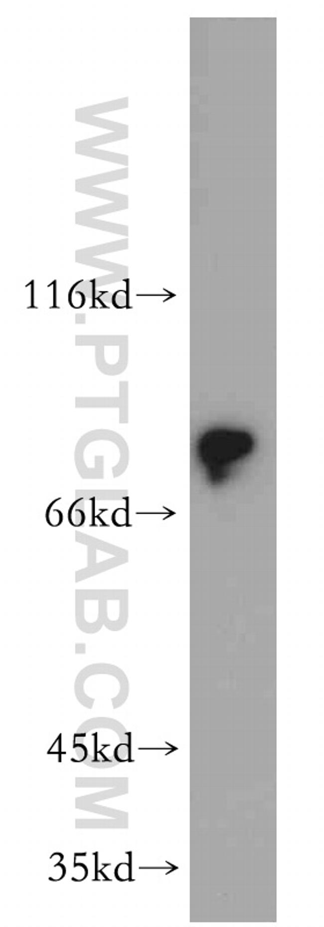 DCLK1 Antibody in Western Blot (WB)