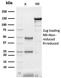 Heart Fatty Acid Binding Protein (H-FABP)/FABP3 Antibody in SDS-PAGE (SDS-PAGE)