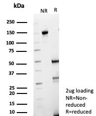 Heart Fatty Acid Binding Protein (H-FABP)/FABP3 Antibody in SDS-PAGE (SDS-PAGE)