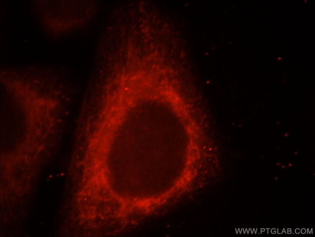 UQCRC1 Antibody in Immunocytochemistry (ICC/IF)