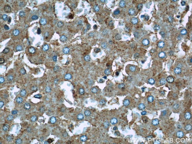 UQCRC1 Antibody in Immunohistochemistry (Paraffin) (IHC (P))