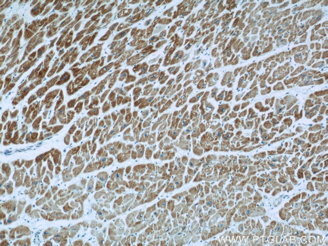 UQCRC1 Antibody in Immunohistochemistry (Paraffin) (IHC (P))