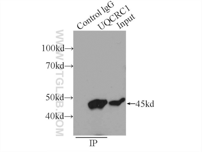 UQCRC1 Antibody in Immunoprecipitation (IP)