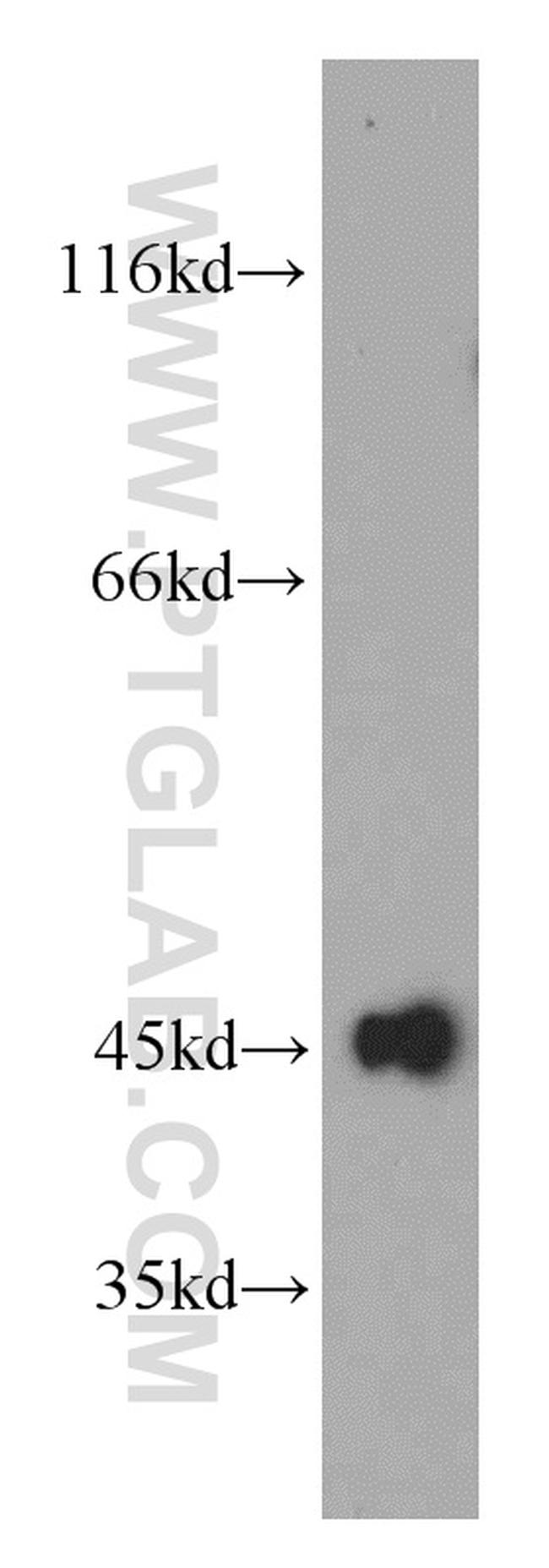 UQCRC1 Antibody in Western Blot (WB)