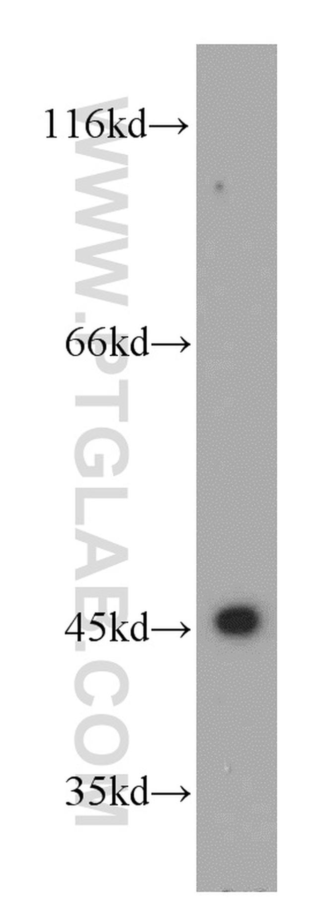 UQCRC1 Antibody in Western Blot (WB)