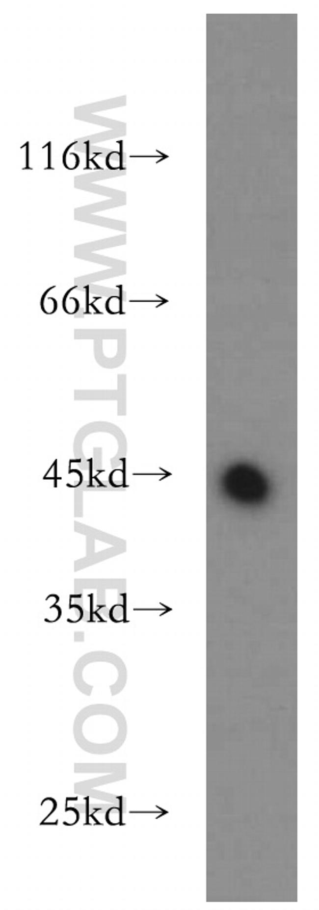 UQCRC1 Antibody in Western Blot (WB)