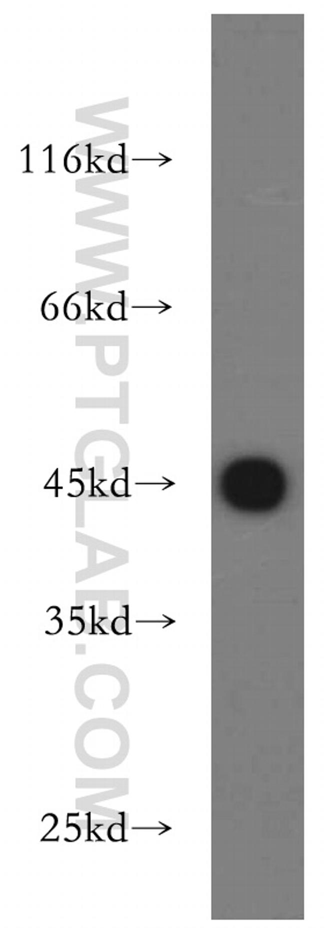 UQCRC1 Antibody in Western Blot (WB)