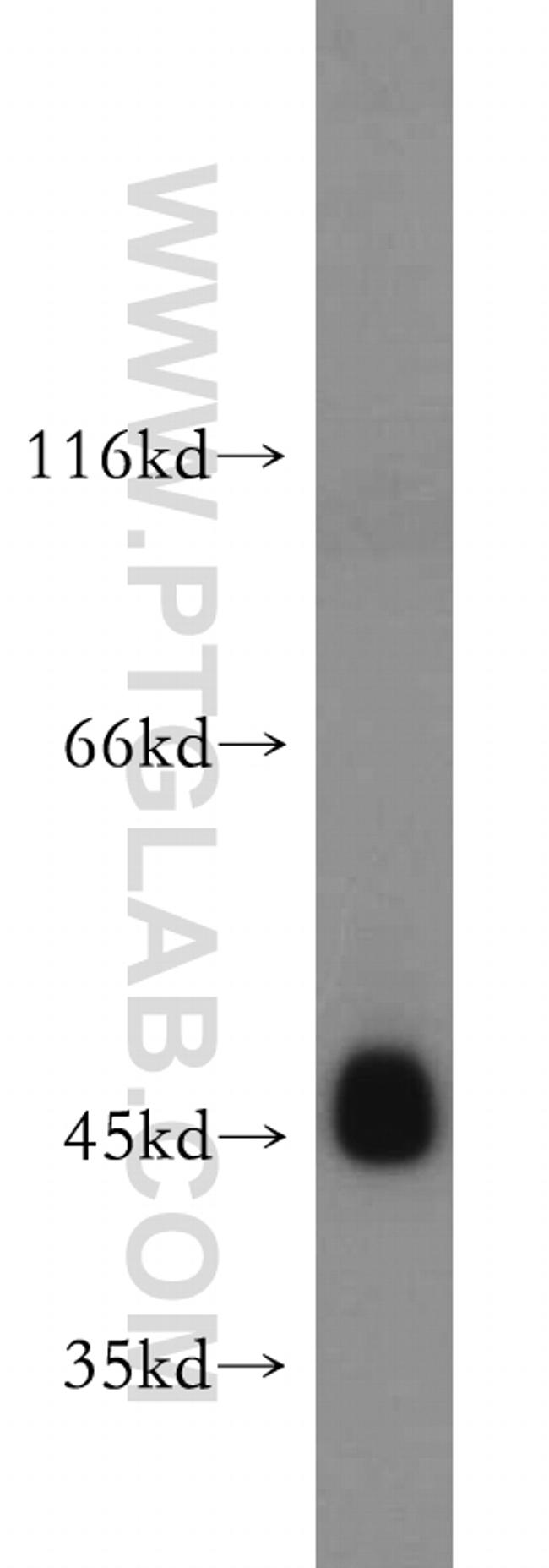 UQCRC1 Antibody in Western Blot (WB)