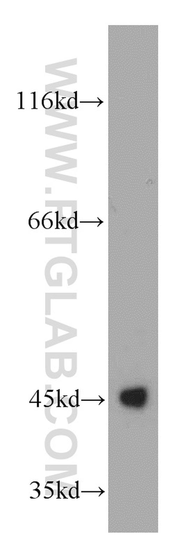 UQCRC1 Antibody in Western Blot (WB)