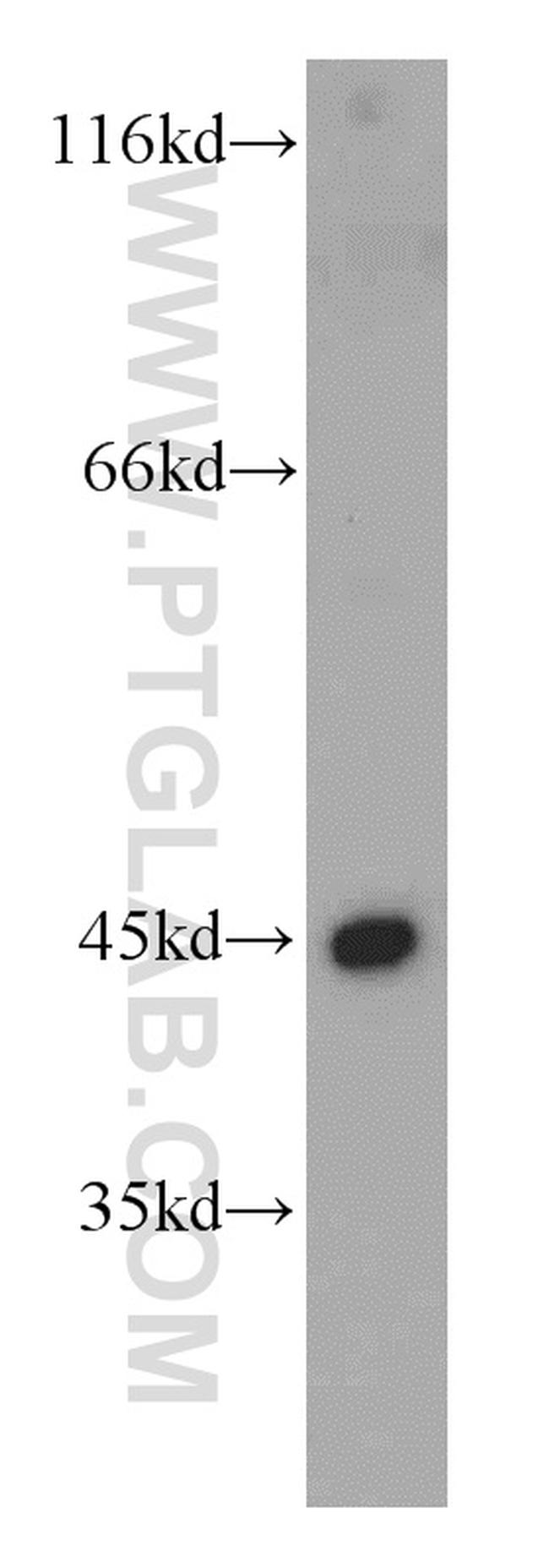 UQCRC1 Antibody in Western Blot (WB)