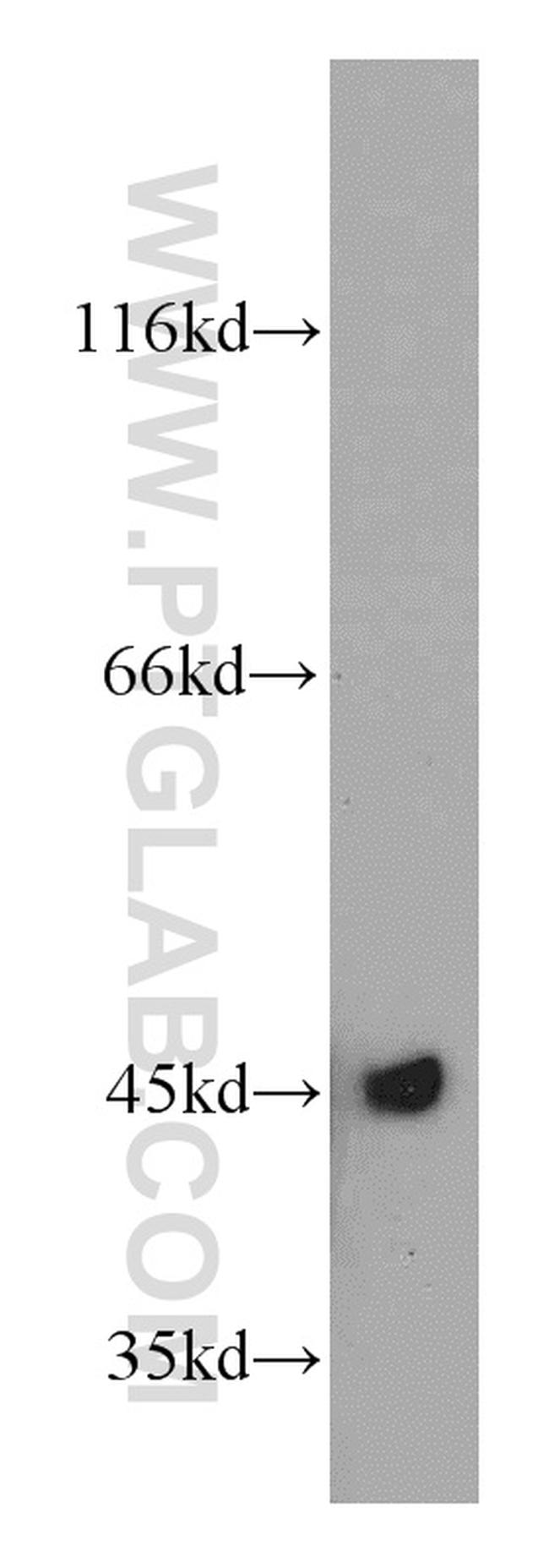 UQCRC1 Antibody in Western Blot (WB)