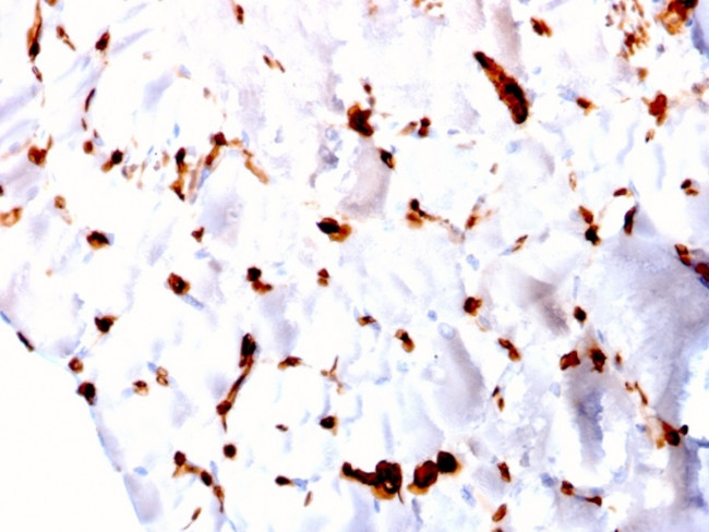 FABP5 Antibody in Immunohistochemistry (Paraffin) (IHC (P))