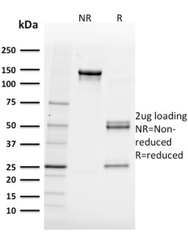 FABP5 Antibody in SDS-PAGE (SDS-PAGE)