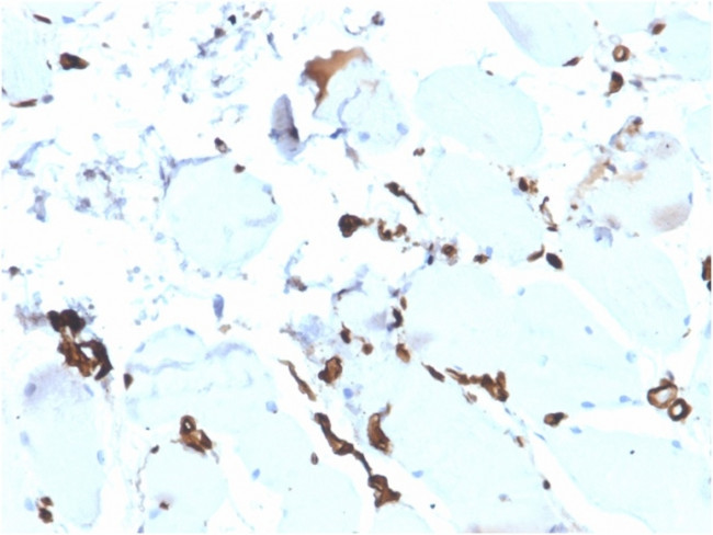 FABP5 (Marker of Metastatic Potential in Colorectal Cancer) Antibody in Immunohistochemistry (Paraffin) (IHC (P))