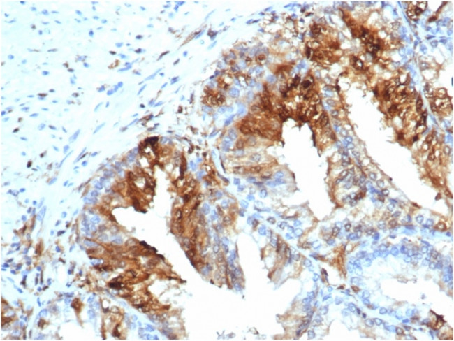 FABP5 (Marker of Metastatic Potential in Colorectal Cancer) Antibody in Immunohistochemistry (Paraffin) (IHC (P))