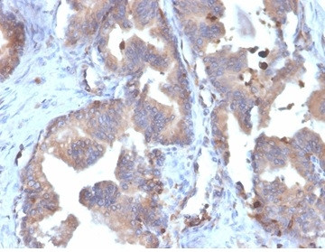 FABP5 (Marker of Metastatic Potential in Colorectal Cancer) Antibody in Immunohistochemistry (Paraffin) (IHC (P))