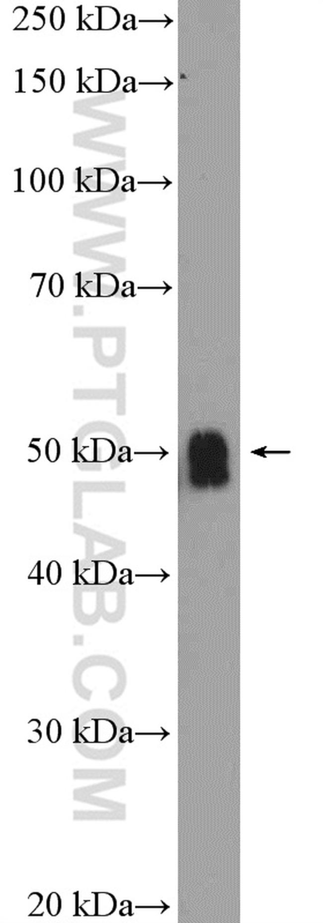 ZIC3 Antibody in Western Blot (WB)