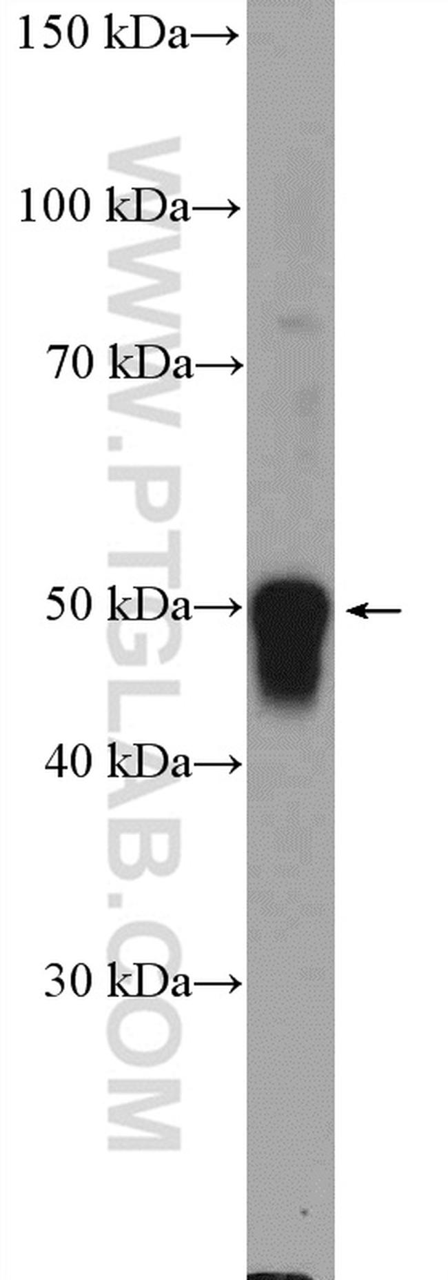 ZIC3 Antibody in Western Blot (WB)