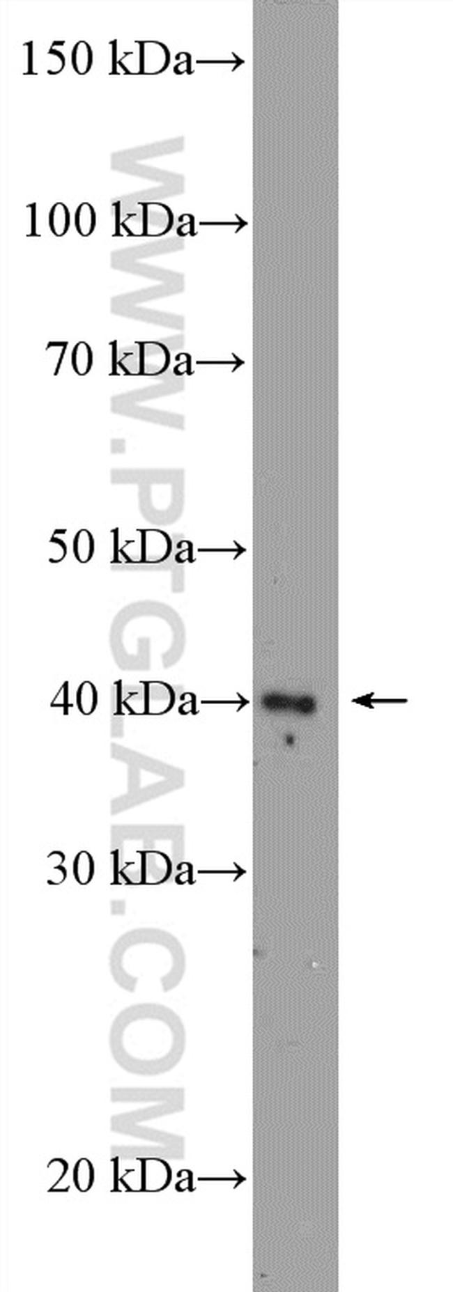 ZIC3 Antibody in Western Blot (WB)