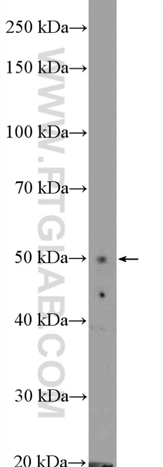 ZIC3 Antibody in Western Blot (WB)