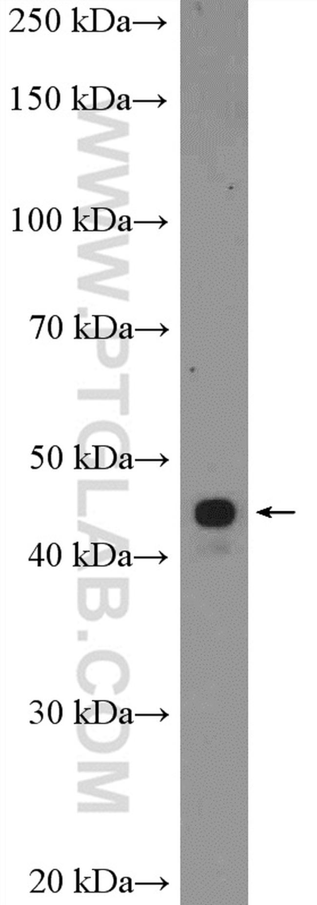 ZIC3 Antibody in Western Blot (WB)