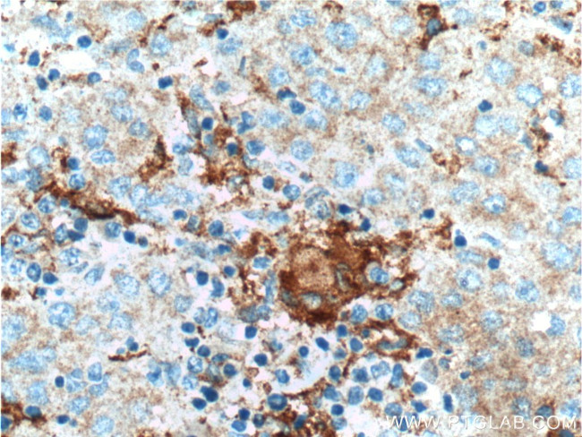 PFKFB1 Antibody in Immunohistochemistry (Paraffin) (IHC (P))