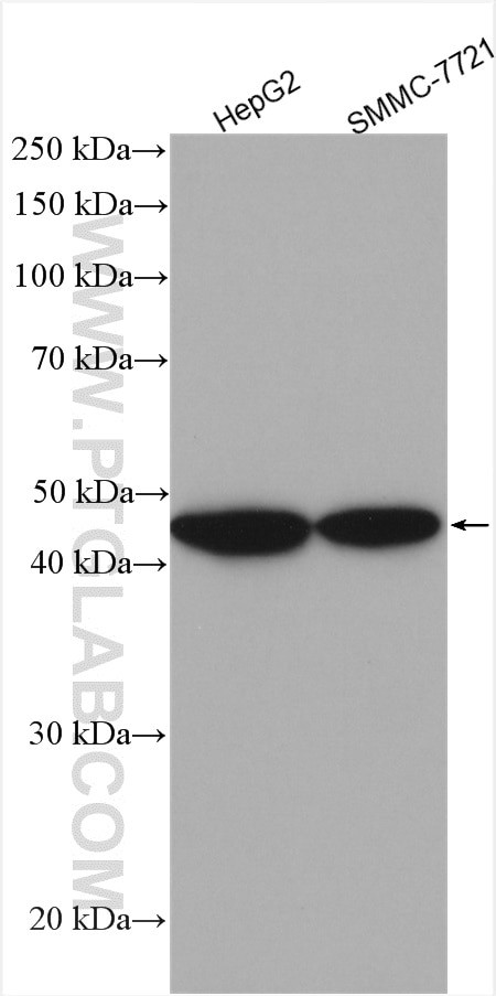 PFKFB1 Antibody in Western Blot (WB)