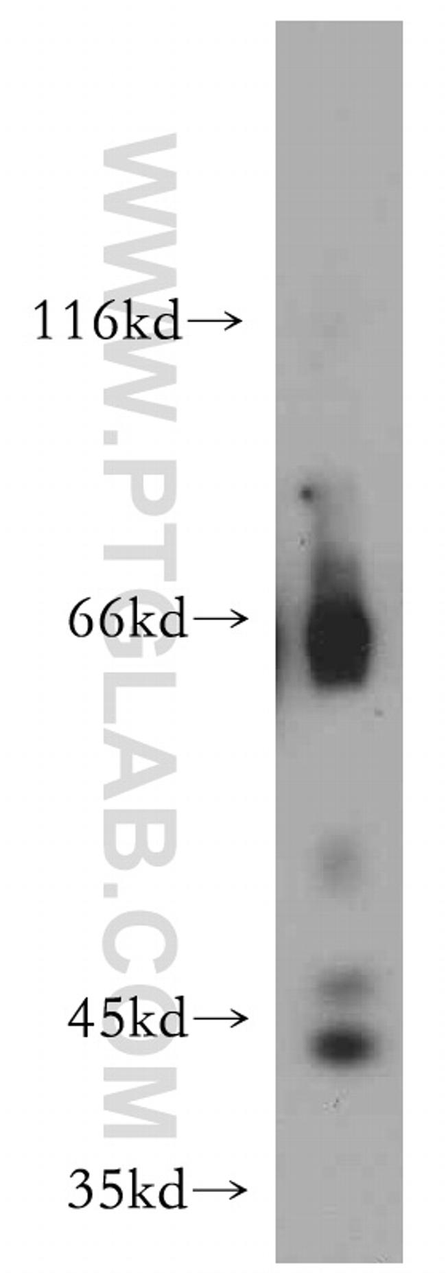 INPP5A Antibody in Western Blot (WB)