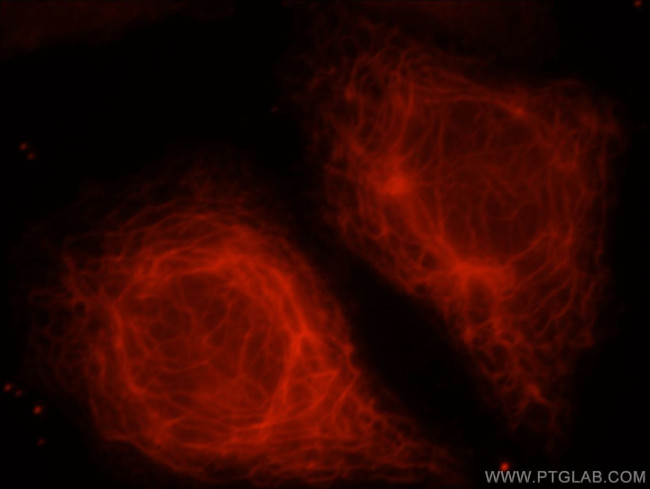 KANK2 Antibody in Immunocytochemistry (ICC/IF)