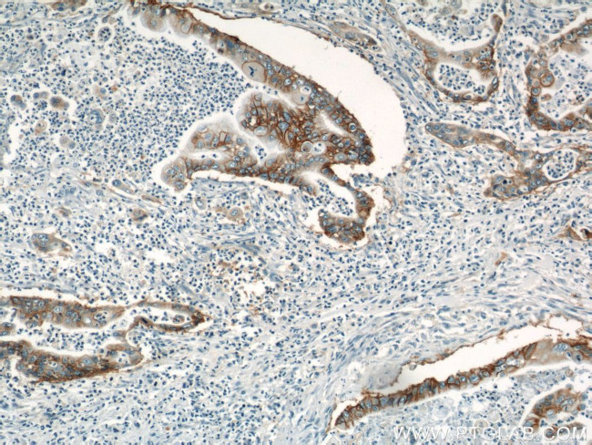 Integrin beta-4 Antibody in Immunohistochemistry (Paraffin) (IHC (P))