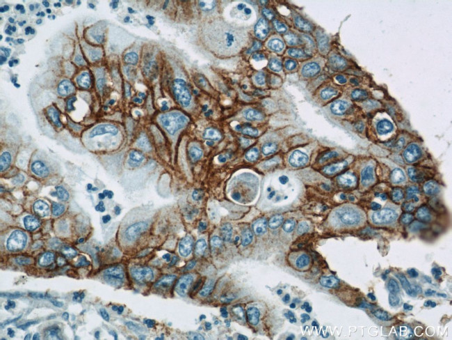 Integrin beta-4 Antibody in Immunohistochemistry (Paraffin) (IHC (P))