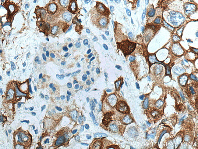 Integrin beta-4 Antibody in Immunohistochemistry (Paraffin) (IHC (P))