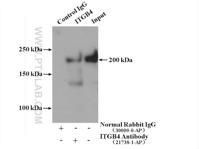 Integrin beta-4 Antibody in Immunoprecipitation (IP)