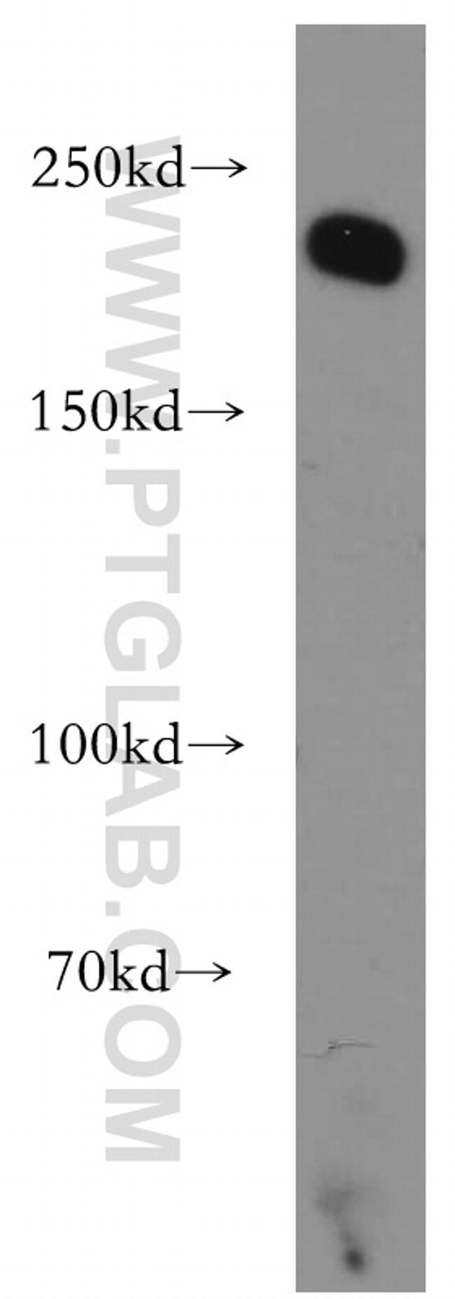 Integrin beta-4 Antibody in Western Blot (WB)