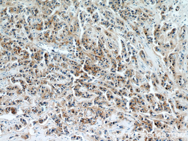 Integrin beta-4 Antibody in Immunohistochemistry (Paraffin) (IHC (P))