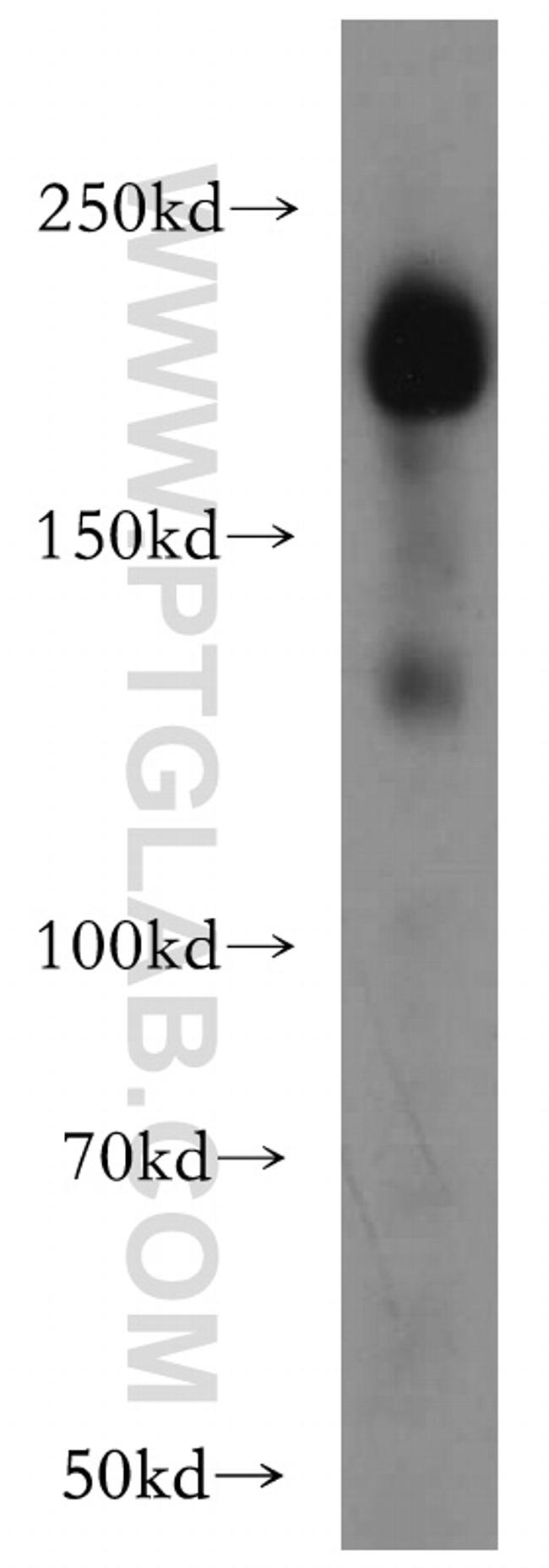 Integrin beta-4 Antibody in Western Blot (WB)