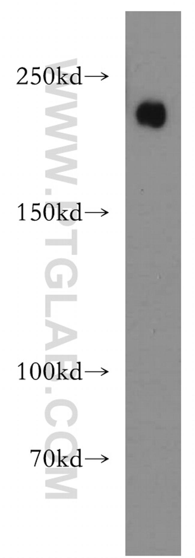 Integrin beta-4 Antibody in Western Blot (WB)