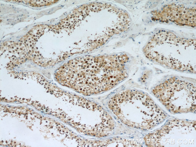 PI3K p110(beta) Antibody in Immunohistochemistry (Paraffin) (IHC (P))