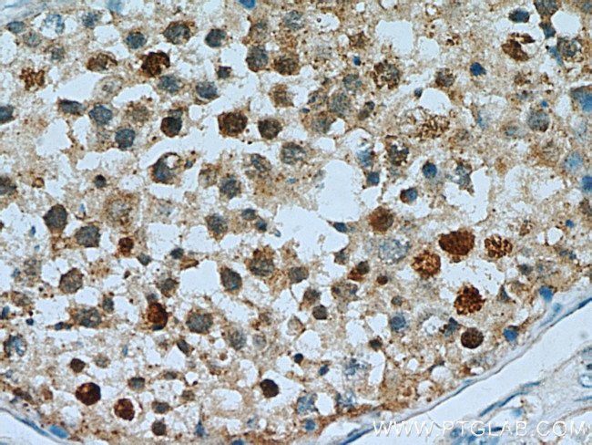 PI3K p110(beta) Antibody in Immunohistochemistry (Paraffin) (IHC (P))