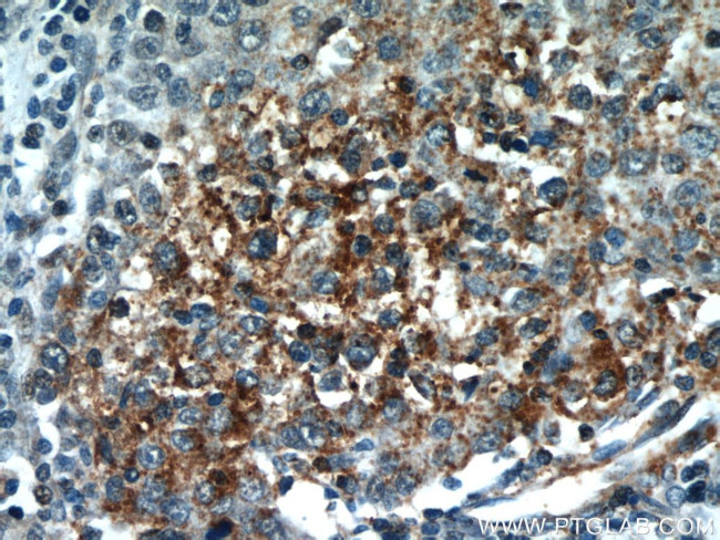 PI3K p110(beta) Antibody in Immunohistochemistry (Paraffin) (IHC (P))