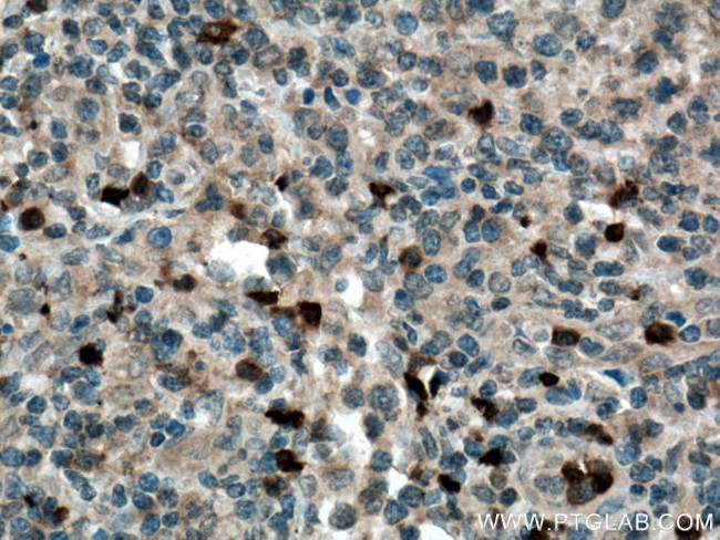 CARD11 Antibody in Immunohistochemistry (Paraffin) (IHC (P))